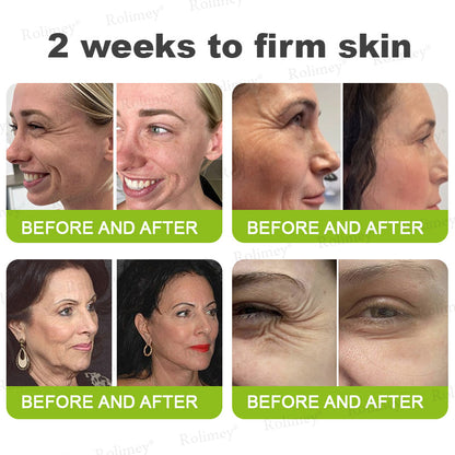 🧑‍⚕️ Rolimey® Botox-Like Peptides + Vita-A Retinol Shot – Wrinkle-Lift Tightening Cream - Last Day Promotion 50% OFF