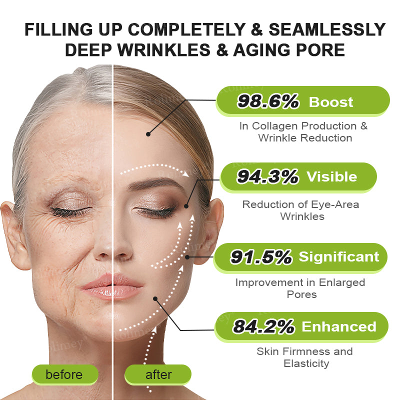 🧑‍⚕️ Rolimey® Botox-Like Peptides + Vita-A Retinol Shot – Wrinkle-Lift Tightening Cream - Last Day Promotion 50% OFF