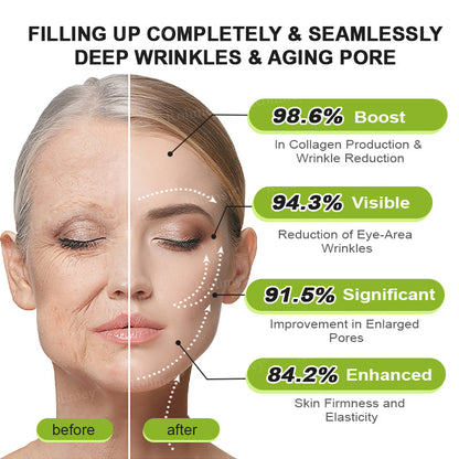 🧑‍⚕️ Rolimey® Botox-Like Peptides + Vita-A Retinol Shot – Wrinkle-Lift Tightening Cream - Last Day Promotion 50% OFF