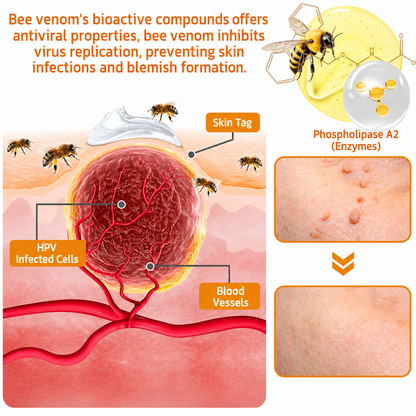 🥇👨‍⚕️Rolimey® Bee Venom Skin Treatment Cream - (Helping with acne, wart, rosacea, psoriasis, age spots, eczema, and reducing the appearance of stretch marks)