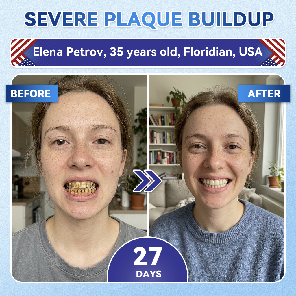 Smile instantly 🦷 GFOUK®⭐⭐ 𝑇𝑖𝑑𝑒𝑔𝑙𝑢𝑠𝑖𝑏 𝑇𝑜𝑜𝑡ℎ & 𝐺𝑢𝑚 𝑅𝑒𝑝𝑎𝑖𝑟 𝐹𝑎𝑠𝑡-𝐷𝑖𝑠𝑠𝑜𝑙𝑣𝑖𝑛𝑔 𝑊ℎ𝑖𝑡𝑒𝑛𝑖𝑛𝑔 𝑆𝑡𝑟𝑖𝑝𝑠  (𝟓-𝐢𝐧-𝟏 💎 𝐑𝐞𝐛𝐮𝐢𝐥𝐝 𝐄𝐧𝐚𝐦𝐞𝐥 & 𝐃𝐞𝐧𝐭𝐢𝐧 • 𝐒𝐭𝐫𝐞𝐧𝐠𝐭𝐡𝐞𝐧 𝐆𝐮𝐦𝐬 • 𝐄𝐫𝐚𝐝𝐢𝐜𝐚𝐭𝐞 𝐓𝐚𝐫𝐭𝐚𝐫 & 𝐎𝐝𝐨𝐫 • 𝐖𝐡𝐢𝐭𝐞𝐧𝐢𝐧𝐠 • 𝐒𝐭𝐨𝐩 𝐓𝐨𝐨𝐭𝐡 𝐒𝐞𝐧𝐬𝐢𝐭𝐢𝐯𝐢𝐭𝐲)