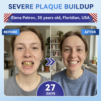 Smile instantly 🦷 GFOUK®⭐⭐ 𝑇𝑖𝑑𝑒𝑔𝑙𝑢𝑠𝑖𝑏 𝑇𝑜𝑜𝑡ℎ & 𝐺𝑢𝑚 𝑅𝑒𝑝𝑎𝑖𝑟 𝐹𝑎𝑠𝑡-𝐷𝑖𝑠𝑠𝑜𝑙𝑣𝑖𝑛𝑔 𝑊ℎ𝑖𝑡𝑒𝑛𝑖𝑛𝑔 𝑆𝑡𝑟𝑖𝑝𝑠  (𝟓-𝐢𝐧-𝟏 💎 𝐑𝐞𝐛𝐮𝐢𝐥𝐝 𝐄𝐧𝐚𝐦𝐞𝐥 & 𝐃𝐞𝐧𝐭𝐢𝐧 • 𝐒𝐭𝐫𝐞𝐧𝐠𝐭𝐡𝐞𝐧 𝐆𝐮𝐦𝐬 • 𝐄𝐫𝐚𝐝𝐢𝐜𝐚𝐭𝐞 𝐓𝐚𝐫𝐭𝐚𝐫 & 𝐎𝐝𝐨𝐫 • 𝐖𝐡𝐢𝐭𝐞𝐧𝐢𝐧𝐠 • 𝐒𝐭𝐨𝐩 𝐓𝐨𝐨𝐭𝐡 𝐒𝐞𝐧𝐬𝐢𝐭𝐢𝐯𝐢𝐭𝐲)