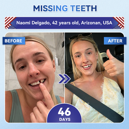 Smile instantly 🦷 GFOUK®⭐⭐ 𝑇𝑖𝑑𝑒𝑔𝑙𝑢𝑠𝑖𝑏 𝑇𝑜𝑜𝑡ℎ & 𝐺𝑢𝑚 𝑅𝑒𝑝𝑎𝑖𝑟 𝐹𝑎𝑠𝑡-𝐷𝑖𝑠𝑠𝑜𝑙𝑣𝑖𝑛𝑔 𝑊ℎ𝑖𝑡𝑒𝑛𝑖𝑛𝑔 𝑆𝑡𝑟𝑖𝑝𝑠  (𝟓-𝐢𝐧-𝟏 💎 𝐑𝐞𝐛𝐮𝐢𝐥𝐝 𝐄𝐧𝐚𝐦𝐞𝐥 & 𝐃𝐞𝐧𝐭𝐢𝐧 • 𝐒𝐭𝐫𝐞𝐧𝐠𝐭𝐡𝐞𝐧 𝐆𝐮𝐦𝐬 • 𝐄𝐫𝐚𝐝𝐢𝐜𝐚𝐭𝐞 𝐓𝐚𝐫𝐭𝐚𝐫 & 𝐎𝐝𝐨𝐫 • 𝐖𝐡𝐢𝐭𝐞𝐧𝐢𝐧𝐠 • 𝐒𝐭𝐨𝐩 𝐓𝐨𝐨𝐭𝐡 𝐒𝐞𝐧𝐬𝐢𝐭𝐢𝐯𝐢𝐭𝐲)