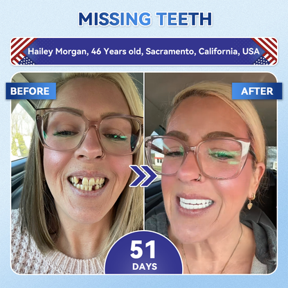 Smile instantly 🦷 GFOUK®⭐⭐ 𝑇𝑖𝑑𝑒𝑔𝑙𝑢𝑠𝑖𝑏 𝑇𝑜𝑜𝑡ℎ & 𝐺𝑢𝑚 𝑅𝑒𝑝𝑎𝑖𝑟 𝐹𝑎𝑠𝑡-𝐷𝑖𝑠𝑠𝑜𝑙𝑣𝑖𝑛𝑔 𝑊ℎ𝑖𝑡𝑒𝑛𝑖𝑛𝑔 𝑆𝑡𝑟𝑖𝑝𝑠  (𝟓-𝐢𝐧-𝟏 💎 𝐑𝐞𝐛𝐮𝐢𝐥𝐝 𝐄𝐧𝐚𝐦𝐞𝐥 & 𝐃𝐞𝐧𝐭𝐢𝐧 • 𝐒𝐭𝐫𝐞𝐧𝐠𝐭𝐡𝐞𝐧 𝐆𝐮𝐦𝐬 • 𝐄𝐫𝐚𝐝𝐢𝐜𝐚𝐭𝐞 𝐓𝐚𝐫𝐭𝐚𝐫 & 𝐎𝐝𝐨𝐫 • 𝐖𝐡𝐢𝐭𝐞𝐧𝐢𝐧𝐠 • 𝐒𝐭𝐨𝐩 𝐓𝐨𝐨𝐭𝐡 𝐒𝐞𝐧𝐬𝐢𝐭𝐢𝐯𝐢𝐭𝐲)