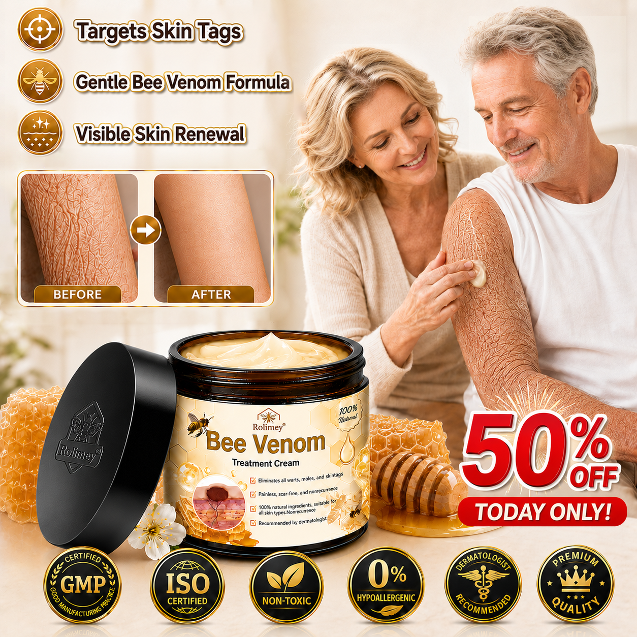 🥇👨‍⚕️Rolimey® Bee Venom Skin Treatment Cream - (Helping with acne, wart, rosacea, psoriasis, age spots, eczema, and reducing the appearance of stretch marks)