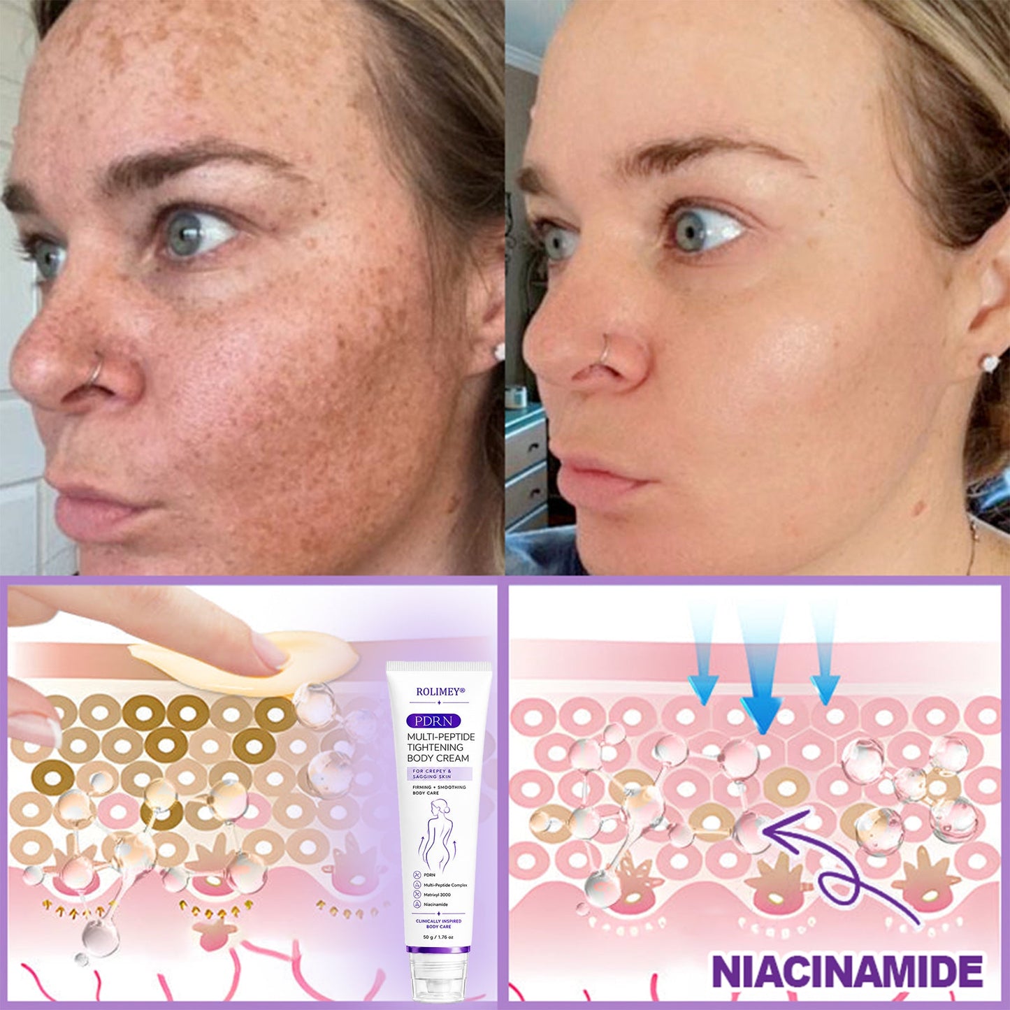 ROLIMEY® 𝐏𝐃𝐑𝐍 𝐌𝐮𝐥𝐭𝐢-𝐏𝐞𝐩𝐭𝐢𝐝𝐞 𝐌𝐚𝐬𝐬𝐚𝐠𝐢𝐧𝐠 𝐁𝐨𝐝𝐲 𝐑𝐨𝐥𝐥𝐞𝐫 𝐂𝐫𝐞𝐚𝐦- 𝐀𝐧𝐭𝐢-𝐚𝐠𝐢𝐧𝐠, 𝐇𝐲𝐝𝐫𝐚𝐭𝐢𝐧𝐠, 𝐒𝐤𝐢𝐧 𝐅𝐢𝐫𝐦𝐢𝐧𝐠 & 𝐋𝐢𝐟𝐭𝐢𝐧𝐠, 𝐒𝐤𝐢𝐧 𝐑𝐞𝐩𝐚𝐢𝐫, 𝐄𝐯𝐞𝐧 𝐓𝐨𝐧𝐞, 𝐀𝐜𝐧𝐞 𝐚𝐧𝐝 𝐃𝐚𝐫𝐤 𝐒𝐩𝐨𝐭 𝐓𝐫𝐞𝐚𝐭𝐦𝐞𝐧𝐭, 𝐖𝐚𝐫𝐭 𝐚𝐧𝐝 𝐌𝐨𝐥𝐞 𝐑𝐞𝐦𝐨𝐯𝐚𝐥, 𝐚𝐧𝐝 𝐏𝐬𝐨𝐫𝐢𝐚𝐬𝐢𝐬 𝐑𝐞𝐥𝐢𝐞𝐟.